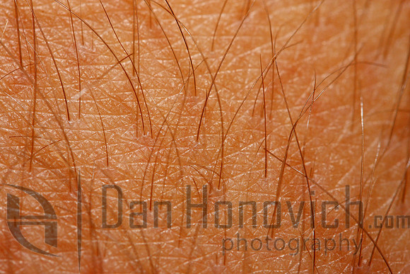 Leg hair